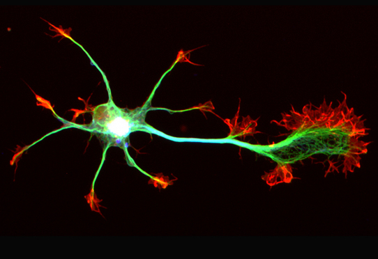 La huntingtine sauve les neurones déficients (étude)