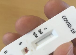 Coronavirus : Les tests rapides disponibles en pharmacie Coronavirus : Les tests rapides disponibles en pharmacie