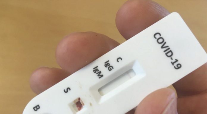 Coronavirus : Les tests rapides disponibles en pharmacie Coronavirus : Les tests rapides disponibles en pharmacie