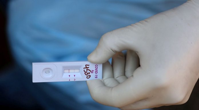 Coronavirus : Québec doit rendre les tests rapides accessibles au grand public Coronavirus : Québec doit rendre les tests rapides accessibles au grand public
